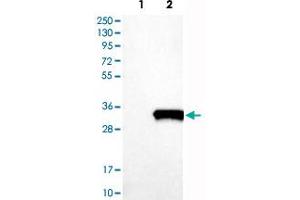 Western Blot analysis of Lane 1: negative control (vector only transfected HEK293T cell lysate) and Lane 2: over-expression lysate (co-expressed with a C-terminal myc-DDK tag in mammalian HEK293T cells) with SNAP25 polyclonal antibody .