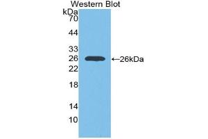 Western blot analysis of the recombinant protein. (IGF1R antibody  (AA 763-955))