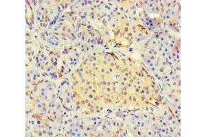 Immunohistochemistry of paraffin-embedded human pancreatic tissue using ABIN7158821 at dilution of 1:100 (LYG2 antibody  (AA 20-212))