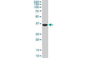 Western Blotting (WB) image for anti-PDZ Binding Kinase (PBK) (AA 1-110) antibody (ABIN599274) (PBK antibody  (AA 1-110))
