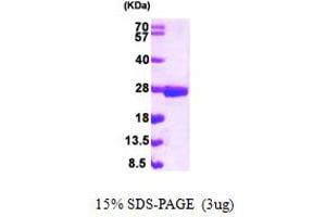 SDS-PAGE (SDS) image for Nudix (Nucleoside Diphosphate Linked Moiety X)-Type Motif 3 (NUDT3) (AA 1-172) protein (His tag) (ABIN667357) (NUDT3 Protein (AA 1-172) (His tag))