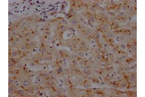 IHC image of ABIN7127393 diluted at 1:100 and staining in paraffin-embedded human liver tissue performed on a Leica BondTM system. (Recombinant CD13 antibody)