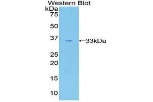 Western Blotting (WB) image for anti-GRB2-Associated Binding Protein 3 (GAB3) (AA 332-583) antibody (ABIN1858939) (GAB3 antibody  (AA 332-583))