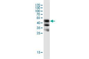 Western Blot detection against Immunogen (43. (AVPI1 antibody  (AA 1-147))
