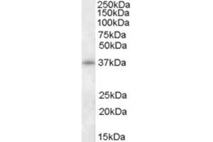 Western Blotting (WB) image for anti-Cyclin-Dependent Kinase 10 (CDK10) (N-Term) antibody (ABIN2466821) (CDK10 antibody  (N-Term))