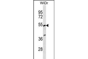 PIGV Antibody (C-term) (ABIN656925 and ABIN2846118) western blot analysis in WiDr cell line lysates (35 μg/lane). (PIGV antibody  (C-Term))