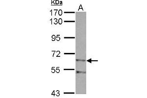 Western Blotting (WB) image for anti-Zinc Finger, Imprinted 2 (ZIM2) (AA 271-490) antibody (ABIN1501825) (ZIM2 antibody  (AA 271-490))