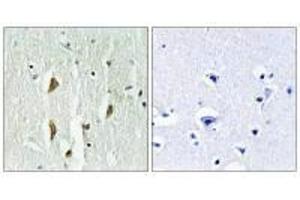 Immunohistochemistry analysis of paraffin-embedded human brain tissue using PAK1/2/3 (Ab-423/402/421) antiobdy. (PAK1/2/3 antibody  (Thr402, Thr421, Thr423))