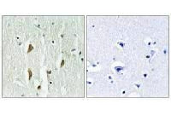 PAK1/2/3 antibody  (Thr402, Thr421, Thr423)