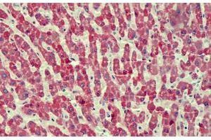 Human Liver: Formalin-Fixed, Paraffin-Embedded (FFPE) (ANTXR2 antibody  (AA 121-133))