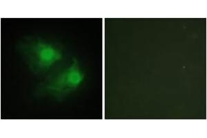 Immunofluorescence analysis of HeLa cells, using LIMK2 Antibody.