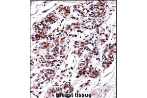 UBP1 Antibody (Center) ((ABIN657986 and ABIN2846933))immunohistochemistry analysis in formalin fixed and paraffin embedded human breast tissue followed by peroxidase conjugation of the secondary antibody and DAB staining. (UBP1 antibody  (AA 266-295))