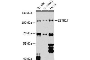 Western blot analysis of extracts of various cell lines, using ZBTB17 Antibody (ABIN6133380, ABIN6150370, ABIN6150371 and ABIN6224531) at 1:1000 dilution. (ZBTB17 antibody  (AA 121-360))