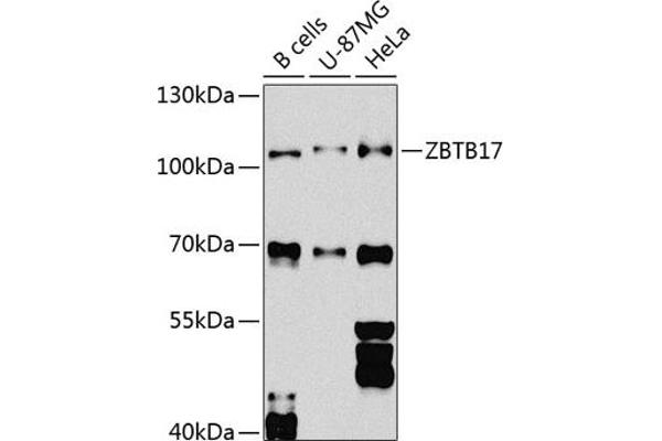 ZBTB17 Antikörper  (AA 121-360)