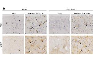 Immunohistochemistry (IHC) image for anti-phosphorylase, Glycogen, Brain (GPBB) (C-Term) antibody (ABIN2855804)