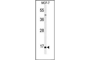 Western blot analysis of FAM44B Antibody (C-term) in MCF-7 cell line lysates (35ug/lane). (BOD1 antibody  (C-Term))