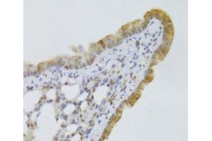 Immunohistochemistry of paraffin-embedded Mouse lung using GPD2 Polyclonal Antibody at dilution of 1:100 (40x lens). (GPD2 antibody)