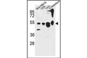 Western blot analysis of KIAA0652 Antibody (N-term) in MDA-MB435, CEM, 47D cell line and mouse cerebellum tissue lysates (35ug/lane). (ATG13 antibody  (N-Term))