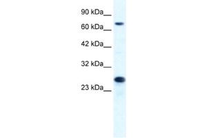 Western Blotting (WB) image for anti-Minichromosome Maintenance Complex Component 6 (MCM6) antibody (ABIN2461394) (MCM6 antibody)
