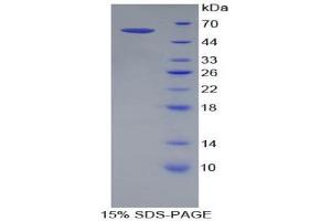 SDS-PAGE (SDS) image for Transforming Growth Factor, beta Receptor III (TGFBR3) (AA 469-724) protein (His tag,GST tag) (ABIN2123699)