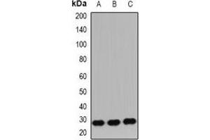 Western blot analysis of IGF2 expression in HepG2 (A), SW480 (B), mouse brain (C) whole cell lysates. (IGF2 antibody)