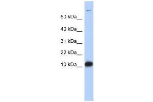 FABP3 antibody used at 1 ug/ml to detect target protein. (FABP3 antibody)