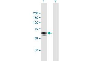 Western Blot analysis of GBA expression in transfected 293T cell line by GBA MaxPab polyclonal antibody. (GBA antibody  (AA 1-536))