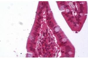 Anti-ACAT1 antibody IHC staining of human small intestine. (ACAT1 antibody)