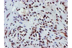 Image no. 11 for anti-Glutathione S-Transferase theta 2 (GSTT2) antibody (ABIN1498553) (GSTT2 antibody)