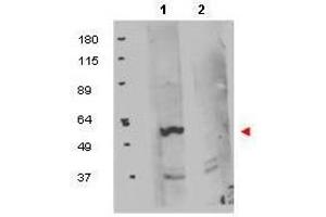 Western blot using  protein A purified anti-FKBP8 antibody shows detection of exogenous FKBP8 in 50 µg of HEK293T whole cell lysate (lane 1). (FKBP8 antibody  (Internal Region))