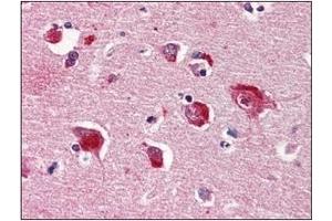 Immunohistochemistry (IHC) image for anti-Protein Phosphatase 1, Catalytic Subunit, alpha Isoform (PPP1CA) (AA 30-299) antibody (ABIN238369) (PPP1CA antibody  (AA 30-299))