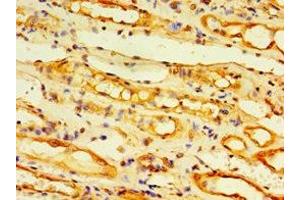 Immunohistochemistry of paraffin-embedded human kidney tissue using ABIN7173881 at dilution of 1:100 (Ectodysplasin A2 Receptor antibody  (AA 1-138))