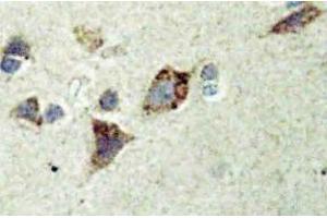 Immunohistochemistry (IHC) analyzes of Rsk-4 antibody in paraffin-embedded human brain tissue. (RPS6KA6 antibody)