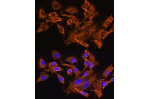 Immunofluorescence analysis of C6 cells using A Rabbit pAb (ABIN6129944, ABIN6137377, ABIN6137378 and ABIN6224448) at dilution of 1:100. (AVPR1A antibody  (AA 349-418))