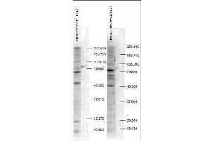 Western blot analysis is shown using  Affinity Purified anti-SH3BP2 pS427 antibody to detect endogenous protein present in unstimulated human whole cell lysates). (SH3BP2 antibody  (pSer427))