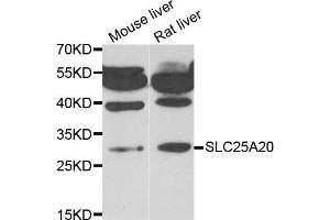 Western blot analysis of extracts of mouse liver and rat liver cell lines, using SLC25A20 antibody. (SLC25A20 antibody)