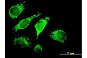 Immunofluorescence of purified MaxPab antibody to DNAJA3 on HeLa cell. (DNAJA3 antibody  (AA 1-480))