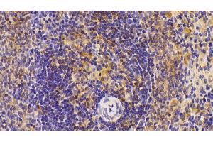 Detection of IL6 in Rat Spleen Tissue using Polyclonal Antibody to Interleukin 6 (IL6) (IL-6 antibody  (AA 21-211))