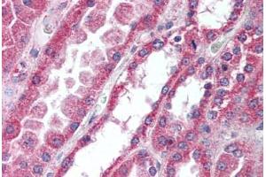 Human Kidney (formalin-fixed, paraffin-embedded) stained with IRAK4 antibody ABIN297197 at 10 ug/ml followed by biotinylated goat anti-rabbit IgG secondary antibody ABIN481713, alkaline phosphatase-streptavidin and chromogen. (IRAK4 antibody  (AA 38-54))