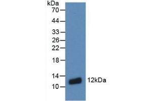 Western blot analysis of recombinant Human S100A8. (S100A8 antibody  (AA 1-93))
