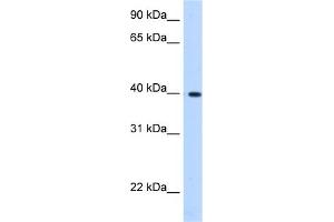 WB Suggested Anti-LIAS Antibody Titration:  0. (LIAS antibody  (C-Term))