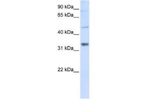 ZCCHC17 antibody used at 1 ug/ml to detect target protein. (ZCCHC17 antibody  (Middle Region))