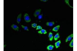 Immunofluorescent analysis of A549 cells using ABIN7173237 at dilution of 1:100 and Alexa Fluor 488-congugated AffiniPure Goat Anti-Rabbit IgG(H+L) (TMEM53 antibody  (AA 1-170))