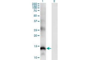 Western Blot analysis of SLPI expression in transfected 293T cell line by SLPI monoclonal antibody (M01), clone 3C6. (SLPI antibody  (AA 33-132))
