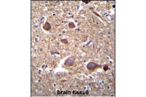 ITPKB Antibody (N-term) (ABIN652430 and ABIN2842237) immunohistochemistry analysis in formalin fixed and paraffin embedded human brain tissue followed by peroxidase conjugation of the secondary antibody and DAB staining. (ITPKB antibody  (N-Term))
