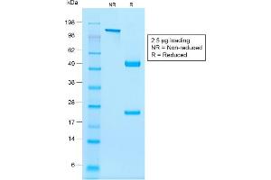SDS-PAGE Analysis Purified NKX2. (Recombinant Nkx2-2 antibody)