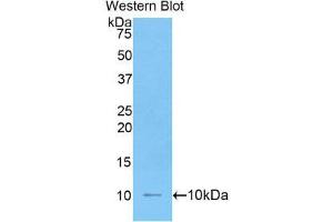 Western Blotting (WB) image for anti-Interleukin 6 Receptor (IL6R) (AA 19-10) antibody (ABIN2120229)