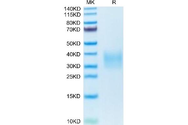 TNFRSF10B Protein (AA 53-180) (His tag)