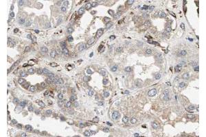 ABIN6272853 at 1/100 staining human kidney tissue sections by IHC-P.