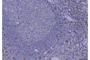 IHC analysis of CD8 alpha using anti-CD8 alpha antibody (ABIN3043499).